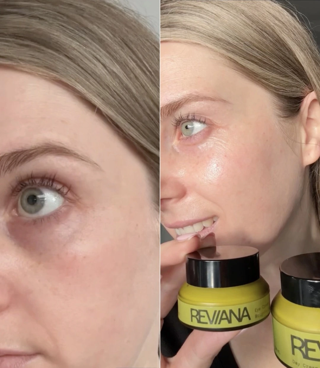 Original Reviana Eye Cream customer photograph